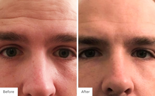 9 - Before and After Real Results photo of a man's face.