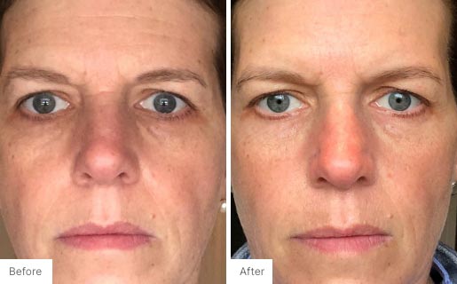 7 - Before and After Real Results image of a woman's face.